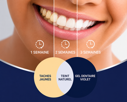 Blanchiment des dents