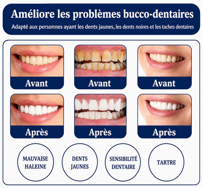 Blanchiment des dents